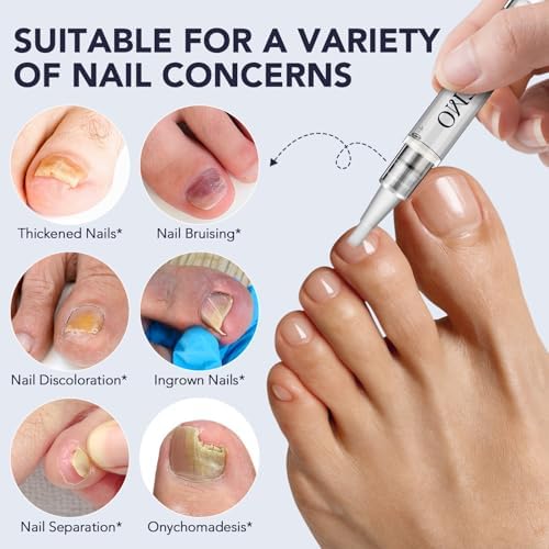 Pack of five KZUO antifungal pens with 25 percent undecylenic acid