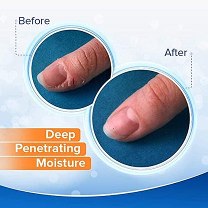 Applying Dermal Therapy hydrating cream to dry cracked fingertips