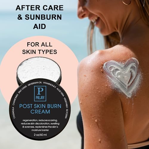 Top view of PolJoy skin repair cream used for treating minor first degree burns.
