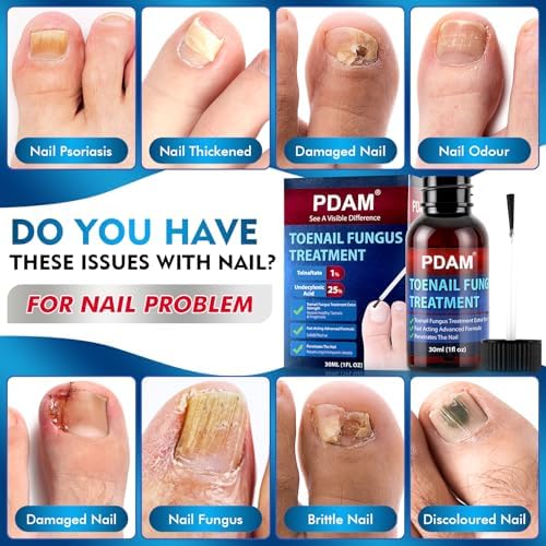 PDAM extra strength toe nail fungus treatment packaging