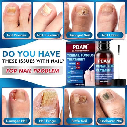 PDAM extra strength toe nail fungus treatment packaging