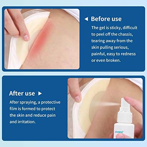 Protective waterproof barrier film application for peristomal skin health