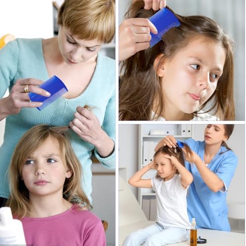 HaiFafafaing professional fine tooth comb being used for scalp psoriasis treatment