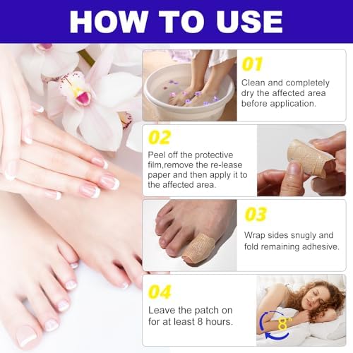 OMZOK extra strength formula for thinning and smoothing thick toenails
