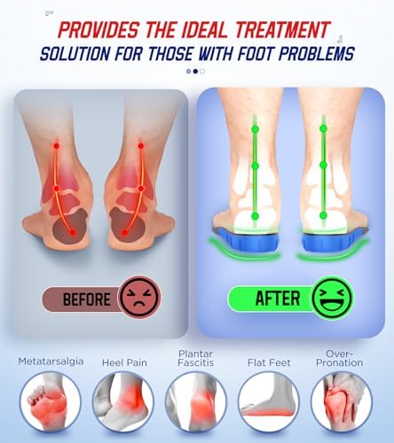 Side profile of Neupu orthotic inserts highlighting the 1.37-inch TPU high arch support structure for flat feet.