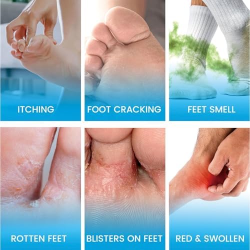 Serynth topical probiotic foot spray bottle showing directions for use and ingredients