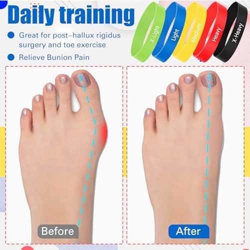 WinnerWhy multicolored toe spacers with black mesh carry bag for portability.