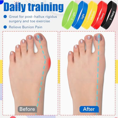 WinnerWhy multicolored toe spacers with black mesh carry bag for portability.