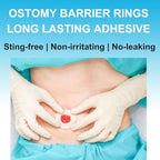 Individual packaging of medical grade forty seven millimeter diameter ostomy seals