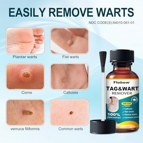 Close up of 30ml wart removal liquid applicator for precise treatment of common and plantar warts