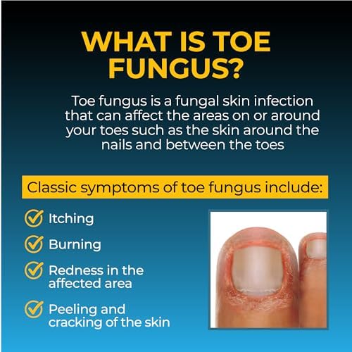 Fungi-Nail bottle with tea tree oil and aloe vera ingredients highlighted