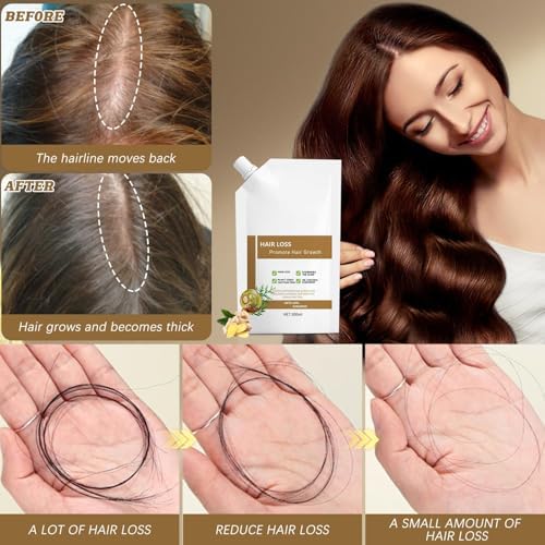 Side profile of Kunbry Remimpi 300 milliliters anti hair fall treatment bottle