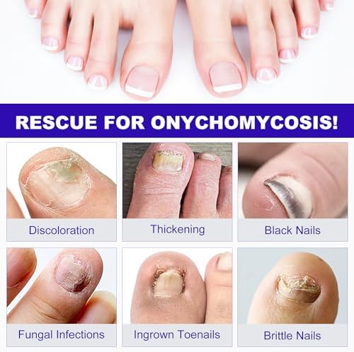 Step by step application guide for secure wrap around nail patches