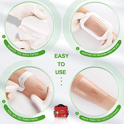 NeuHeils clear adhesive dressing used as a protective shield over a minor burn site