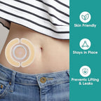 Waterproof ostomy barrier tape being applied to secure a colostomy stoma bag flange.