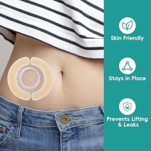 Waterproof ostomy barrier tape being applied to secure a colostomy stoma bag flange.