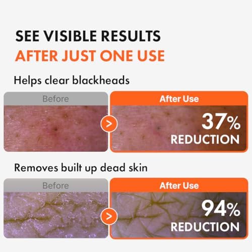 Hanskin 300ml skincare bottle texture display