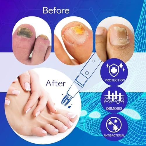 NEOMEN 4 pack nail repair pens for long term grooming