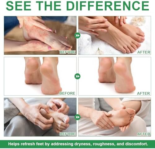 Packaging of Mingyituo USA imported foot care spray for Indian customers