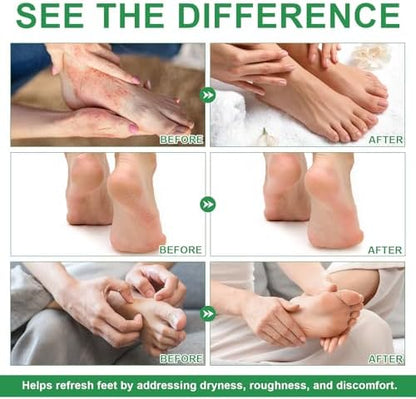 Packaging of Mingyituo USA imported foot care spray for Indian customers
