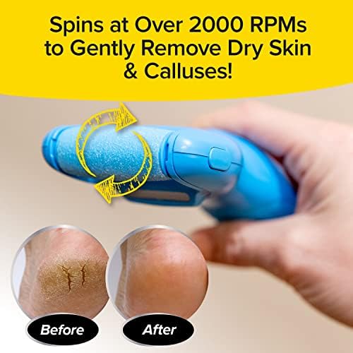 PedEgg Power battery operated foot file showing LED illumination on heel.