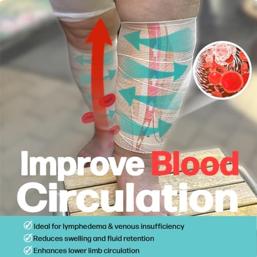 Elastic compression wrap applied to a swollen leg for lymphedema relief.