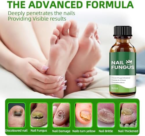 Herbal nail treatment for thick and discolored yellow toenails.