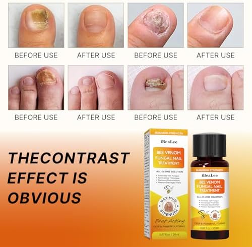 Authentic USA imported nail fungus treatment serum packaging view.