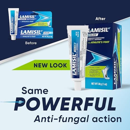 Lamisil Terbinafine Hydrochloride one percent topical cream tube on a white background.