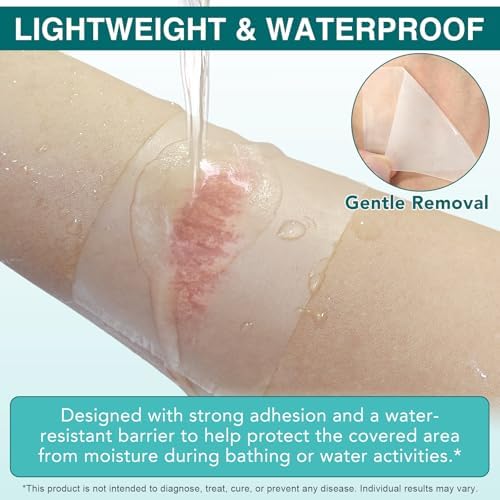 Ultra absorbent self adhesive hydrocolloid bandage roll applied on a joint curve