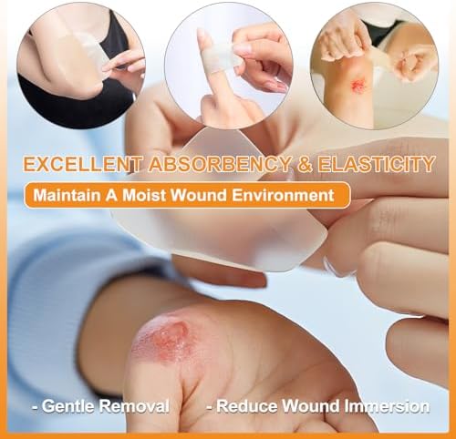 Carbou 20 pack wound care supplies for bedsores and burns