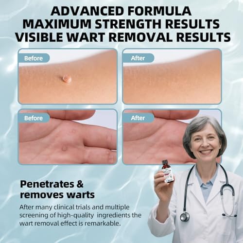 BURRRER maximum strength 17 percent salicylic acid bottle for plantar wart removal.