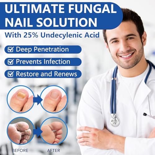 Close up of 25 percent Undecylenic Acid antifungal solution for yellow nails
