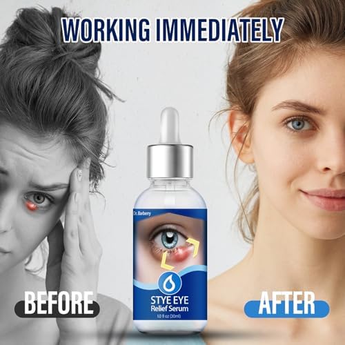 Penntr Stye Eye Relief Serum bottle with cap removed