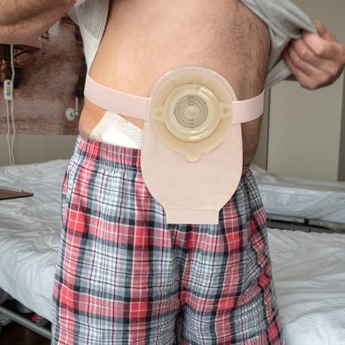 Elastic post operative ileostomy belt demonstrating its stretchable and adjustable design.