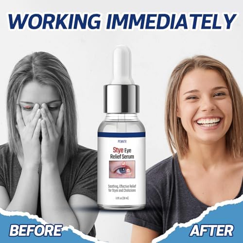Penntr chalazion and blepharitis relief serum container angle view