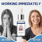 Penntr chalazion and blepharitis relief serum container angle view