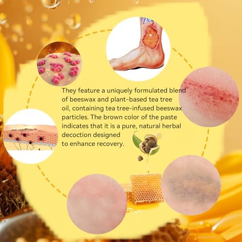 Medical grade honey dressing application for pressure ulcers and deep burns.
