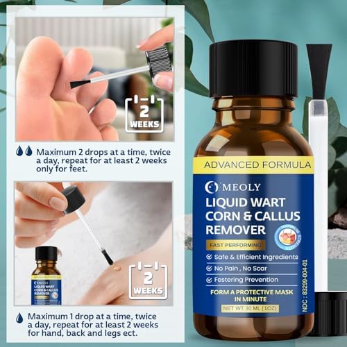 MEOLY wart remover liquid showing 40 percent salicylic acid concentration label
