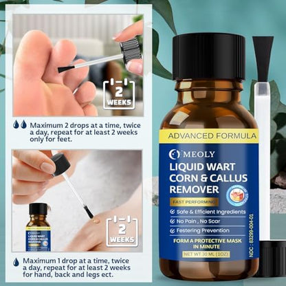 MEOLY wart remover liquid showing 40 percent salicylic acid concentration label