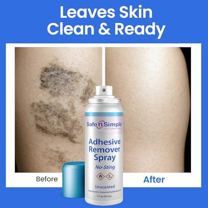 Quick-drying medical tape remover spray for irritation-free wound care.
