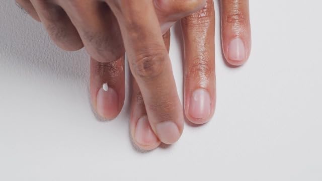 CND nail treatment bottle used for repairing white spots on nails.