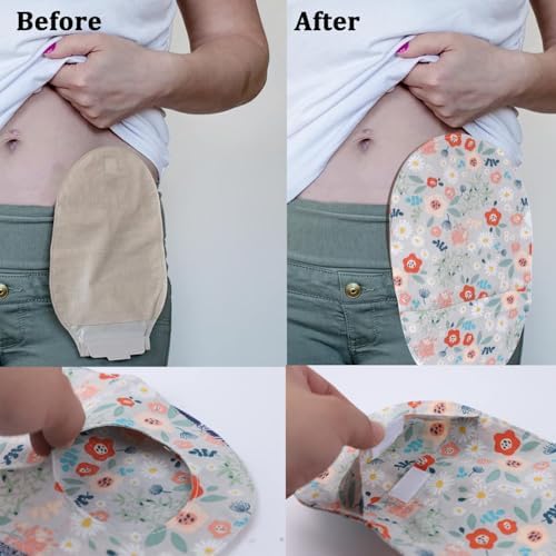 Side view of the ostomy bag cover demonstrating its stretchy and flexible fit.