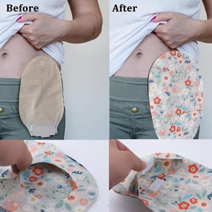 Side view of the ostomy bag cover demonstrating its stretchy and flexible fit.