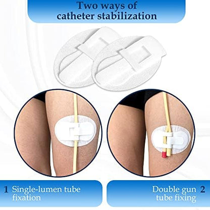 Close up of the locking mechanism on a catheter securement device.