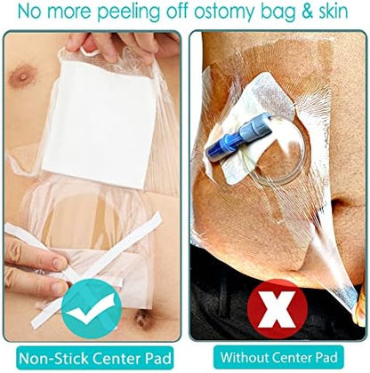 Latex free adhesive border sealing urostomy pouch during bath