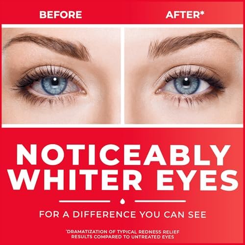 Clear Eyes lubricant eye drops for dry and burning eyes.