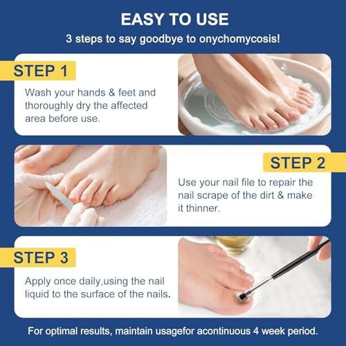 USA imported Drawzone antifungal treatment for ingrown toenail relief.