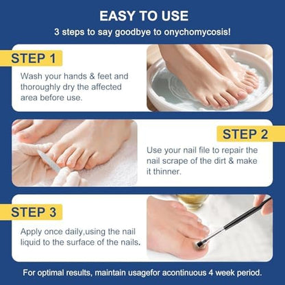 USA imported Drawzone antifungal treatment for ingrown toenail relief.