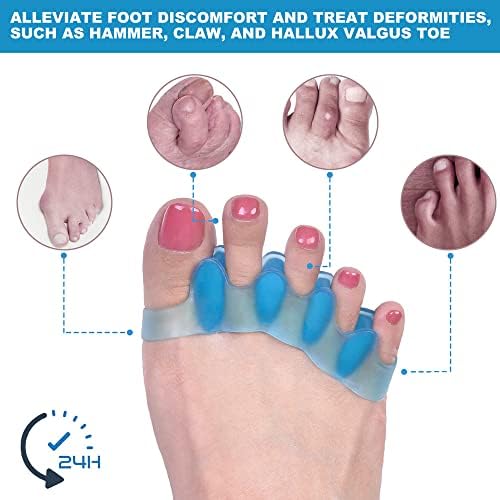 Sosede silicone gel toe spacers being worn on a foot to demonstrate alignment.